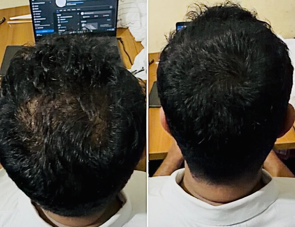 Customer Before After Screenshot